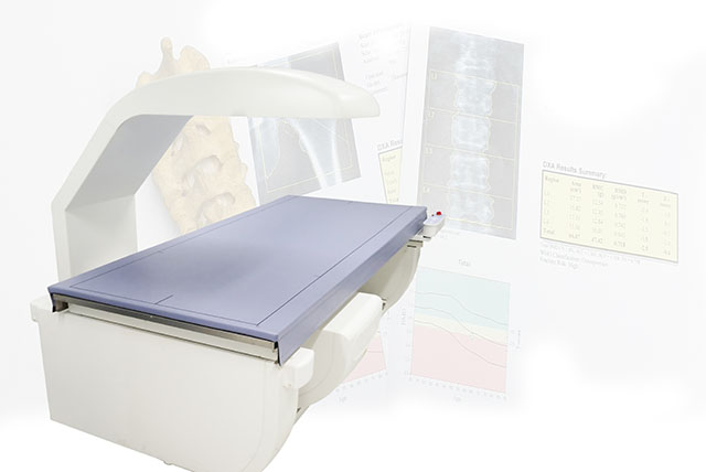 Osteodensitometrie DEXA